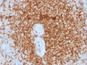 IHC testing of FFPE human spleen tissue with recombinant Bcl-2 antibody (rBCL2/796). HIER: boil tissue sections in 10mM Tris with 1mM EDTA, pH 7.5-8.5, for 10-20 min followed by cooling at RT for 20 min.~