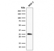 Western blot testing of human MCF7 cell lysate with recombinant Bcl-2 antibody (clone rBCL2/796). Expected molecular weight ~26 kDa.