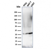 Western blot testing of human samples with recombinant Bcl-2 antibody (clone rBCL2/796). Expected molecular weight ~26 kDa.