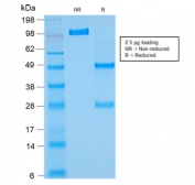 SDS-PAGE analysis of purified, BSA-free recombinant Bcl2 antibody (clone rBCL2/782) as confirmation of integrity and purity.