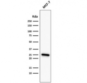 Western blot testing of  human MCF7 cell lysate with recombinant Bcl2 antibody (clone rBCL2/782). Expected molecular weight ~26 kDa.