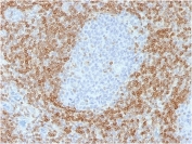 IHC testing of human tonsil tissue with recombinant Bcl2 antibody (rBCL2/782). HIER: boil tissue sections in 1mM EDTA, pH 8, for 10-20 min followed by cooling at RT for 20 min.