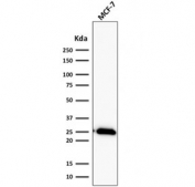 Western blot testing of  human MCF7 cell lysate with recombinant Bcl2 antibody (clone BCL2/2210R). Expected molecular weight ~26 kDa.