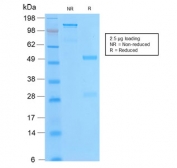SDS-PAGE analysis of purified, BSA-free Bcl-2 antibody (clone BCL2/2210R) as confirmation of integrity and purity.