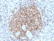 IHC testing of FFPE human spleen tissue with recombinant Bcl-2 antibody (clone BCL2/2210R). HIER: boil tissue sections in 1mM EDTA buffer, pH 8, for 10-20 min followed by cooling at RT for 20 min.