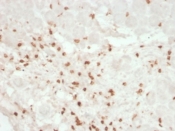 IHC testing of FFPE human colon tissue with recombinant CD8A antibody (clone rC8/468). Required HIER: boil tissue sections in pH9 EDTA for 10-20 min followed by cooling at RT for 20 min.~