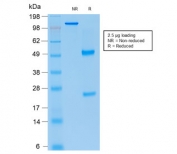 SDS-PAGE analysis of purified, BSA-free recombinant p21 antibody (clone rCIP1/823) as confirmation of integrity and purity.