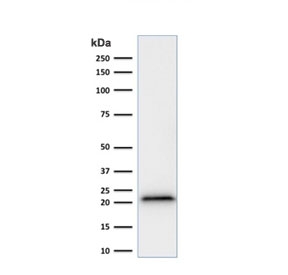 Western blot testing of human HeLa cell lysate with recombinant p21 antibody (clone rCIP1/823).~