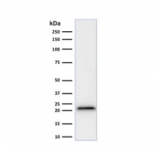 Western blot testing of human HeLa cell lysate with recombinant p21 antibody (clone rCIP1/823).