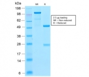 SDS-PAGE analysis of purified, BSA-free recombinant CDNK1A antibody (clone CIP1/2275R) as confirmation of integrity and purity.