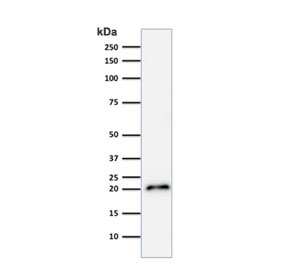 Western blot testing of human HeLa cell lysate with recombinant CDNK1A antibody (clone CIP1/2275R).~