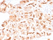IHC testing of FFPE human pancreas with recombinant CFTR antibody (clone CFTR/2290R). HIER: boil tissue sections in 10mM Tris with 1mM EDTA, pH9 for 10-20 min followed by cooling at RT for 20 min.