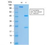 SDS-PAGE analysis of purified, BSA-free recombinant CFTR antibody (clone rCFTR/1342) as confirmation of integrity and purity.