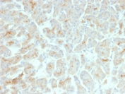 IHC testing of FFPE human pancreas with recombinant CFTR antibody (clone rCFTR/1342). HIER: boil tissue sections in 10mM Tris with 1mM EDTA, pH9 for 10-20 min followed by cooling at RT for 20 min.