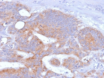 IHC testing of FFPE human colon with recombinant CD86 antibody (rC86/1146). Required HIER: boil tissue sections in 10mM Tris buffer with 1mM EDTA, pH 9.0, for 10-20 min followed by cooling at RT for 20 min.~