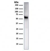 Western blot testing of human Ramos cell lysate with recombinant CD86 antibody. Expected molecular weight: 38-70 kDa depending on glycosylation level.