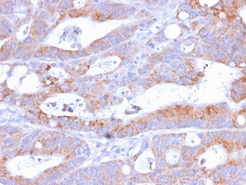 IHC testing of FFPE human colon with recombinant CD86 antibody (C86/2160R). Required HIER: boil tissue sections in 10mM Tris buffer with 1mM EDTA, pH 9.0, for 10-20 min followed by cooling at RT for 20 min.~