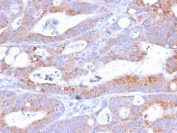 IHC testing of FFPE human colon with recombinant CD86 antibody (C86/2160R). Required HIER: boil tissue sections in 10mM Tris buffer with 1mM EDTA, pH 9.0, for 10-20 min followed by cooling at RT for 20 min.