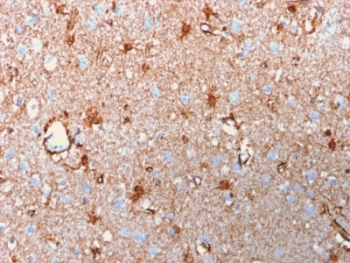IHC testing of FFPE human brain with recombinant S100B antibody (clone rS100B/1896). HIER: steam sections in pH 9 10mM Tris with 1mM EDTA for 10-20 min.