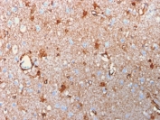 IHC testing of FFPE human brain with recombinant S100B antibody (clone rS100B/1896). HIER: steam sections in pH 9 10mM Tris with 1mM EDTA for 10-20 min.