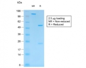 SDS-PAGE analysis of purified, BSA-free recombinant S100B antibody (clone rS100B/1896) as confirmation of integrity and purity.