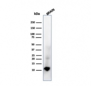 Western blot testing of human brain tissue lysate with recombinant S100B antibody (clone rS100B/1896). Predicted molecular weight ~11 kDa.