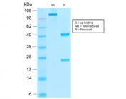 SDS-PAGE analysis of purified, BSA-free recombinant Thrombomodulin antibody (clone rTHBD/1591) as confirmation of integrity and purity.
