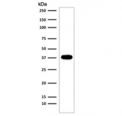 SDS-PAGE analysis of purified, BSA-free recombinant EpCAM antibody (clone EGP40/2041R) as confirmation of integrity and purity.
