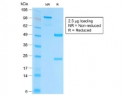 SDS-PAGE analysis of purified, BSA-free recombinant EpCAM antibody (clone EGP40/2041R) as confirmation of integrity and purity.