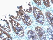 IHC testing of FFPE human colon tissue with recombinant CK8 antibody (clone rB22.1). Required HIER: boil tissue sections in 10mM citrate buffer, pH 6, for 10-20 min followed by cooling at RT for 20 min.