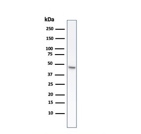 Western blot testing of human HCT-116 cell lysate with recombinant CK8 antibody (clone rB22.1).~