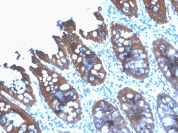 IHC testing of FFPE human colon tissue with recombinant CK8 antibody (clone rB22.1). Required HIER: boil tissue sections in 10mM citrate buffer, pH 6, for 10-20 min followed by cooling at RT for 20 min.~