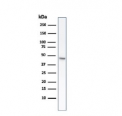 Western blot testing of human HCT-116 cell lysate with recombinant CK8 antibody (clone rB22.1). 