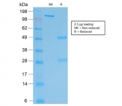 SDS-PAGE analysis of purified, BSA-free recombinant HCG-beta antibody (clone rHCGb/54) as confirmation of integrity and purity.