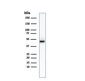 Western blot testing of human HCT-116 cell lysate with recombinant Cytokeratin 8 antibody (clone KRT8/2174R).~