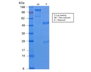 SDS-PAGE analysis of purified, BSA-free recombinant Cytokeratin 8 antibody (clone KRT8/2174R) as confirmation of integrity and