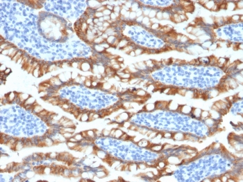 IHC testing of FFPE human small intestine tissue with recombinant Cytokeratin 8 antibody (clone KRT8/2174R). Required HIER: boil tissue sections in 10mM citrate buffer, pH 6, for 10-20 min followed by cooling at RT for 20 min.~