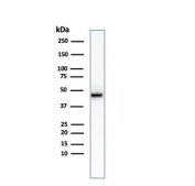 Western blot testing of human HCT-116 cell lysate with recombinant Cytokeratin 8 antibody (clone KRT8/2174R).