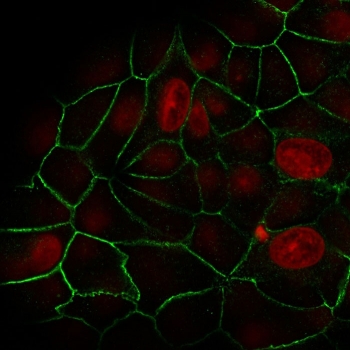 Immunofluorescent staining of human MCF7 cells with recombinant E-Cadherin antibody (green, clone rCDH1/1525) and Reddot nuclear stain (red).