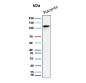 Western blot testing of human placental tissue lysate with recombinant E-Cadherin antibody (clone rCDH1/1525). Expected molecular weight: 135 kDa (precursor), 80-120 kDa (mature, depending on glycosylation level).