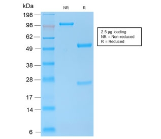 SDS-PAGE analysis of purified, BSA-free recombinant E-Cadherin antibody (clone CDH1/2208R) as confirmation of integrity and purity.