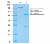 SDS-PAGE analysis of purified, BSA-free recombinant E-Cadherin antibody (clone CDH1/2208R) as confirmation of integrity and purity.