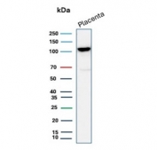 Western blot testing of human placental tissue lysate with recombinant E-Cadherin antibody (clone CDH1/2208R). Expected molecular weight: 135 kDa (precursor), 80-120 kDa (mature, depending on glycosylation level).