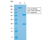 SDS-PAGE analysis of purified, BSA-free recombinant ANO1 antibody (clone rDG1/447) as confirmation of integrity and purity.