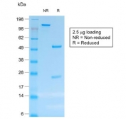 SDS-PAGE analysis of purified, BSA-free recombinant CD30 antibody (clone rCD30/412) as confirmation of integrity and purity.