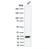 Western blot testing of human HeLa lysate with Ferritin Light Chain antibody. Predicted molecular weight: ~20 kDa.