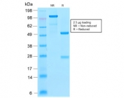 SDS-PAGE analysis of purified, BSA-free recombinant Ferritin Light Chain antibody (clone FTL/2338R) as confirmation of integrity and purity.