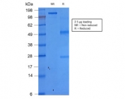 SDS-PAGE analysis of purified, BSA-free recombinant EpCAM antibody (clone rEGP40/1372) as confirmation of integrity and purity.