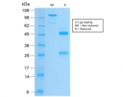 SDS-PAGE analysis of purified, BSA-free recombinant Integrin beta 3 antibody (clone ITGB3/2166R) as confirmation of integrity and purity.