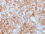 IHC testing of FFPE human spleen with Integrin beta 3 antibody (clone ITGB3/2166R). Required HIER: boil tissue sections in 10mM Tris with 1mM EDTA, pH9, for 10-20 min followed by cooling at RT for 20 min.